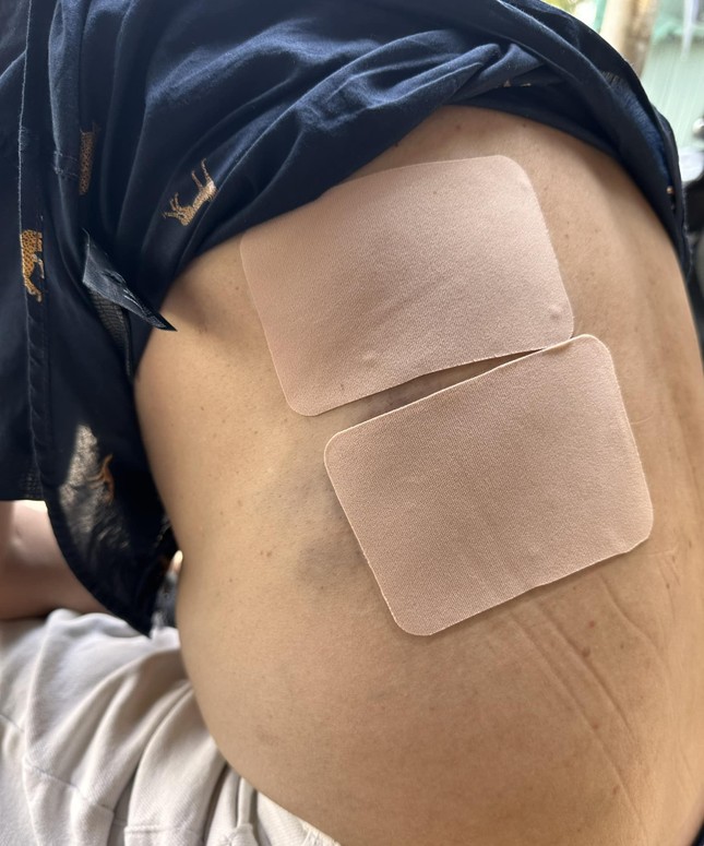 Nghệ sĩ Tấn Beo bất tỉnh sau khi rơi tự do xuống cầu thang-1