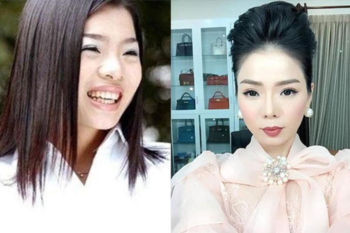 Nhan sắc Lệ Quyên thời chưa nâng mũi và sau 5 năm tháo sụn-4