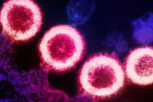 Thông tin thêm về người phụ nữ đầu tiên được ghép tế bào gốc chữa khỏi HIV-1