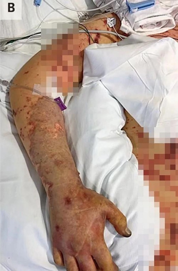 Có người bị mù mắt vì ăn đồ để qua đêm: Ghi nhớ nguyên tắc bảo quản đồ ăn để tránh rước họa-2