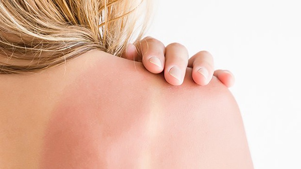 Vì sao bôi kem chống nắng mà da vẫn đen sạm?-9