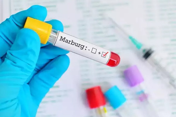 Thêm 5 ca nhiễm virus Marburg tử vong-1
