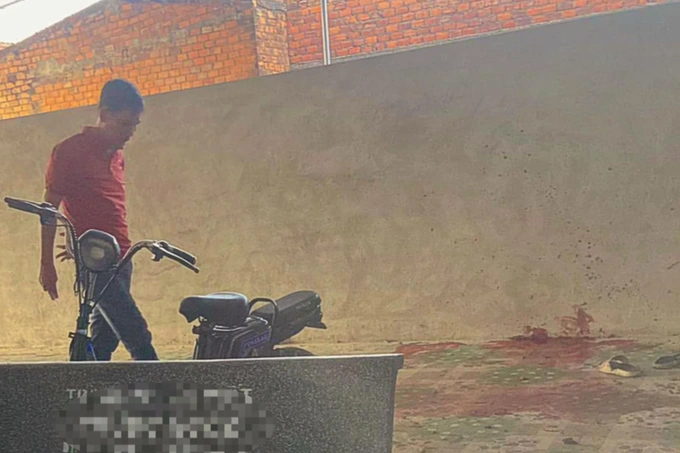 Nam sinh lớp 8 nát cả tay, chân sau vụ nổ lớn-1