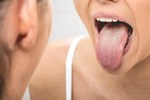 Đi khám vì có dấu hiệu lạ trong miệng, không ngờ nguyên nhân là ung thư-2