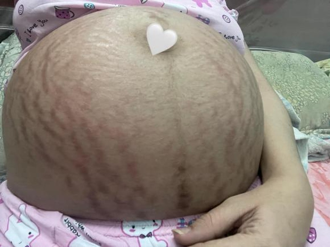 Mẹ bỉm sữa lột xác sau thời gian vượt cạn khiến netizen nức nở-4