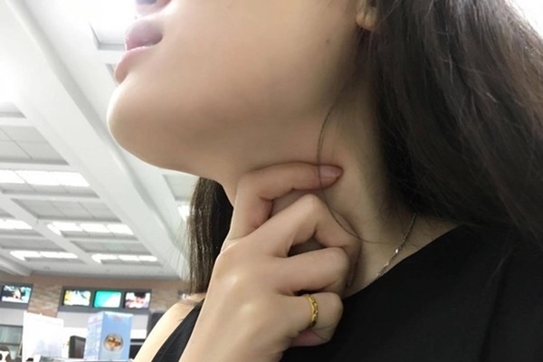 Bác sĩ cảnh báo cách chế biến rau củ làm tăng nguy cơ ung thư vòm họng gấp 7 lần nhưng gia đình Việt nào cũng thích-3