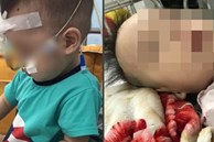 Gia đình bức xúc vì con bất ngờ hôn mê sau khi vào viện điều trị viêm phổi