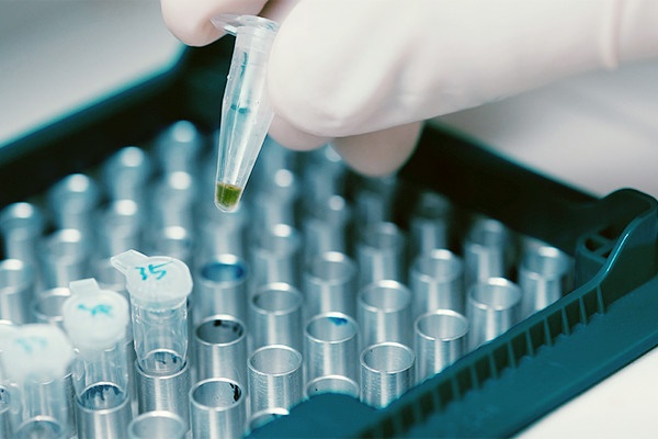 Nhiều trẻ tại Hà Nội diễn biến nặng do mắc virus RSV-12