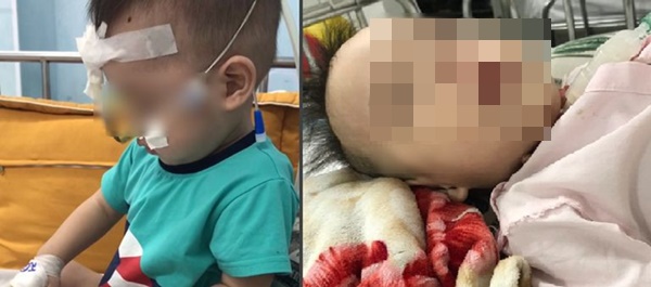 Vụ trẻ đột ngột hôn mê ở TP.HCM: Bệnh viện không thể cung cấp hình ảnh camera-1