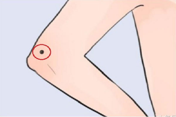 Nốt ruồi ảnh hưởng tới tài vận, giàu sang phú quý hoặc xui rủi về tài lộc-4