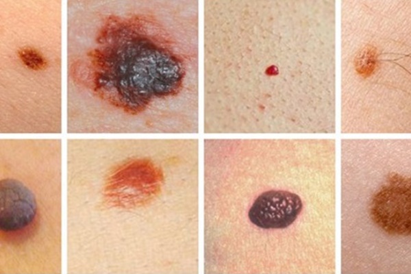 5 bất thường trong khi ăn uống rất có thể là lời cầu cứu” từ cơ thể khi mắc bệnh ung thư-4