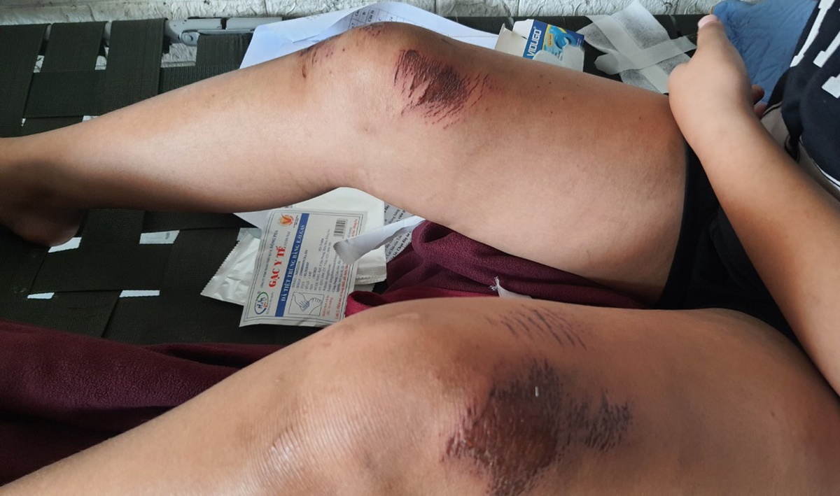 Nghi can trộm điện thoại kéo lê bé gái ở TP.HCM-2