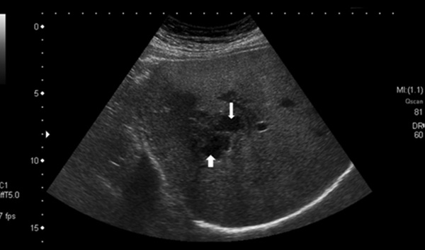 Bệnh viện TP.HCM ghi nhận nhiều ca nguy kịch do thói quen ăn uống-1