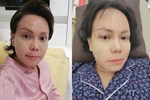 Bị liệt cơ mặt giống Hari Won, Việt Hương: Nam MC tiết lộ sự nguy hiểm của bệnh-6