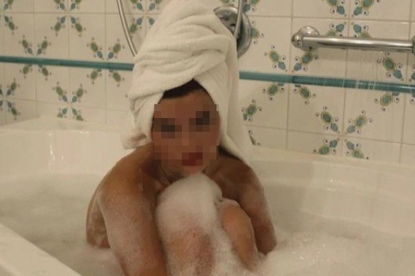 Cô gái 24 tuổi bất ngờ phát hiện viêm vùng kín vì 1 thói quen sạch quá hóa bệnh-3