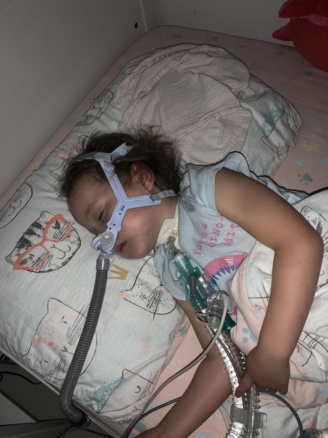 Bé gái 6 tuổi hằng đêm phải thở máy vì mắc bệnh quên thở”-1