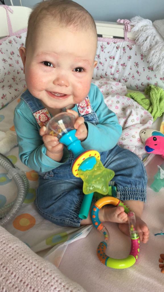 Bé gái 6 tuổi hằng đêm phải thở máy vì mắc bệnh quên thở”-2