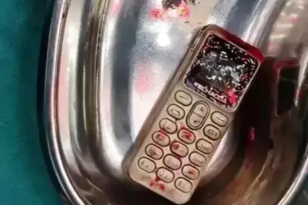 Nói chuyện điện thoại 4 phút 17 giây mỗi ngày, điều gì sẽ xảy ra với sức khỏe?-2