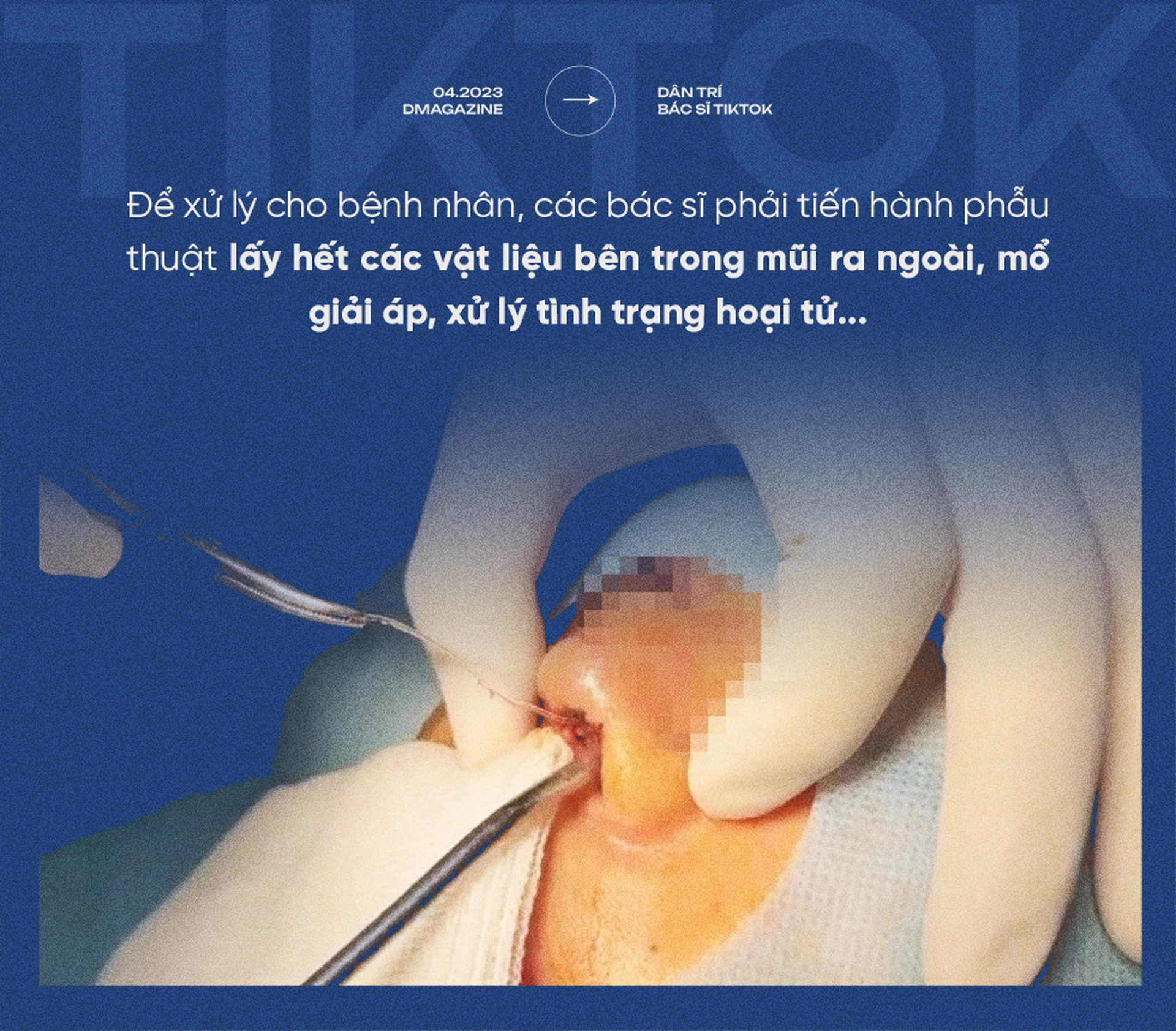 Nát mũi, hỏng mặt, biến chứng thai kỳ vì Bác sĩ Tiktok-2