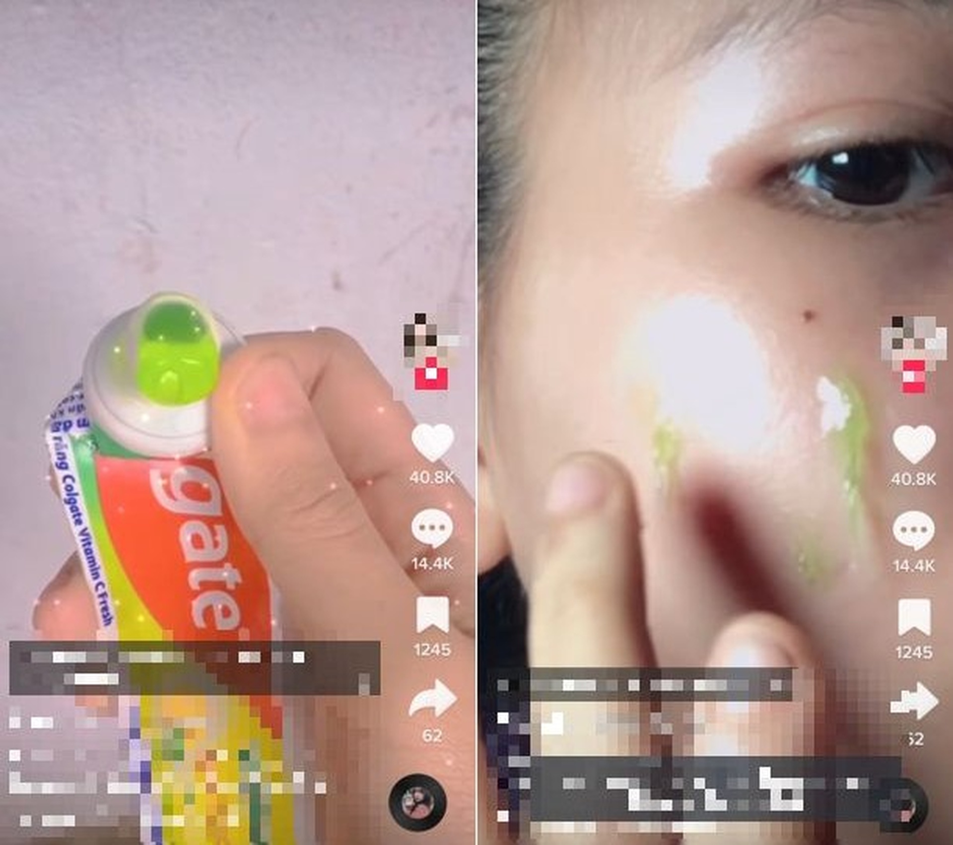 Nát mũi, hỏng mặt, biến chứng thai kỳ vì Bác sĩ Tiktok-4