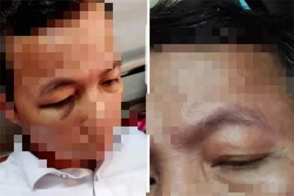 Hiệu trưởng đứng dưới cờ xin lỗi toàn trường vì đánh Hiệu phó bị thương-3