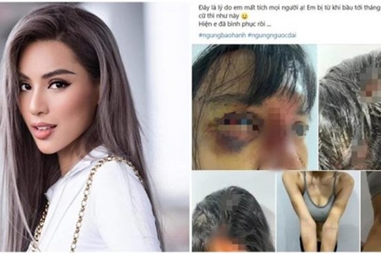 Cuộc sống siêu mẫu bị bạo hành giờ ra sao?