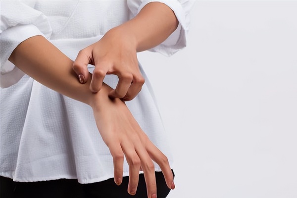 Ngứa liên tục ở 3 chỗ trên cơ thể, đừng nghĩ là dị ứng, có thể liên quan đến lượng đường trong máu quá cao-4