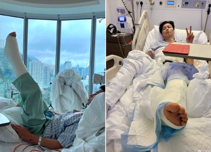 Sao Diệp Vấn gặp tai nạn nghiêm trọng ở phim trường, phải phẫu thuật-1