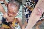 Trẻ 3 tuổi ở Hà Nội bị gãy chân sau khi đi học, phụ huynh yêu cầu làm rõ-3