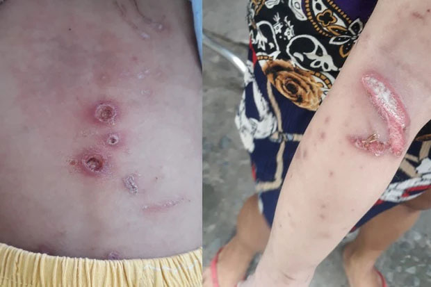 Nghi vấn bé trai ở TP.HCM bị cha mẹ đánh đập dã man, trên người đầy vết thương-1