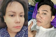 Bị liệt cơ mặt giống Hari Won, Việt Hương: Nam MC tiết lộ sự nguy hiểm của bệnh
