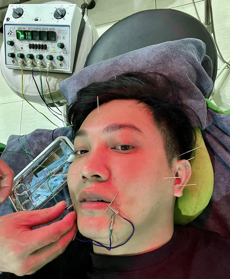 Bị liệt cơ mặt giống Hari Won, Việt Hương: Nam MC tiết lộ sự nguy hiểm của bệnh-2