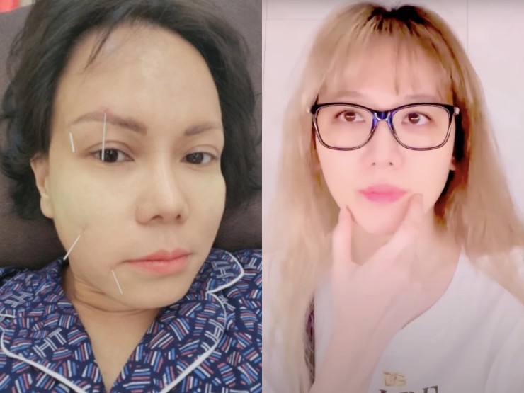 Bị liệt cơ mặt giống Hari Won, Việt Hương: Nam MC tiết lộ sự nguy hiểm của bệnh-5