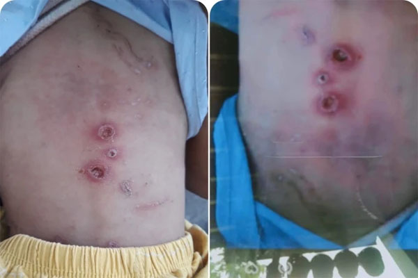 Vụ bé trai nghi bị cha mẹ đánh đập dã man: Người thân cung cấp thông tin bất ngờ-3