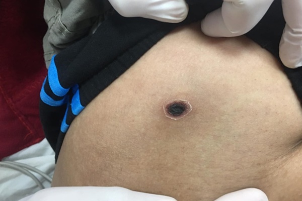 Người đàn ông mắc bệnh truyền nhiễm nguy hiểm-1