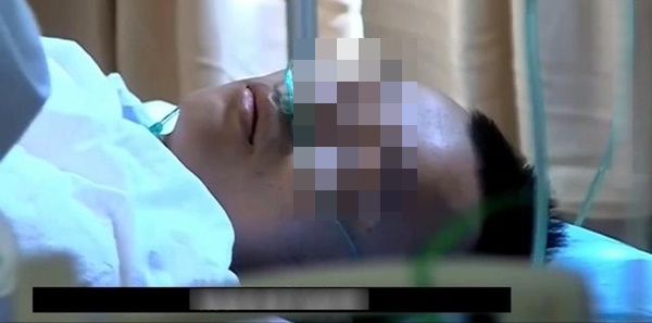 Thanh niên 23 tuổi vốn khỏe mạnh bỗng bị xuất huyết não do thói quen nhiều người làm mỗi đêm-1