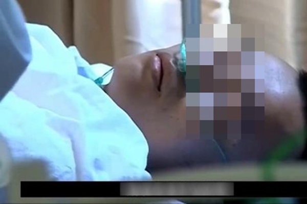 Trước khi xuất hiện cơn xuất huyết não, cơ thể thường có 5 tín hiệu” cần xử lý kịp thời-4