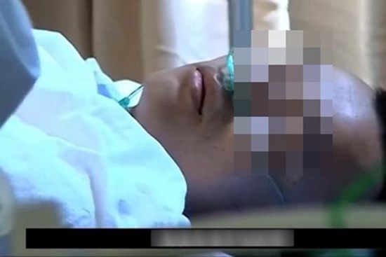 Thanh niên 23 tuổi vốn khỏe mạnh bỗng bị xuất huyết não do thói quen nhiều người làm mỗi đêm