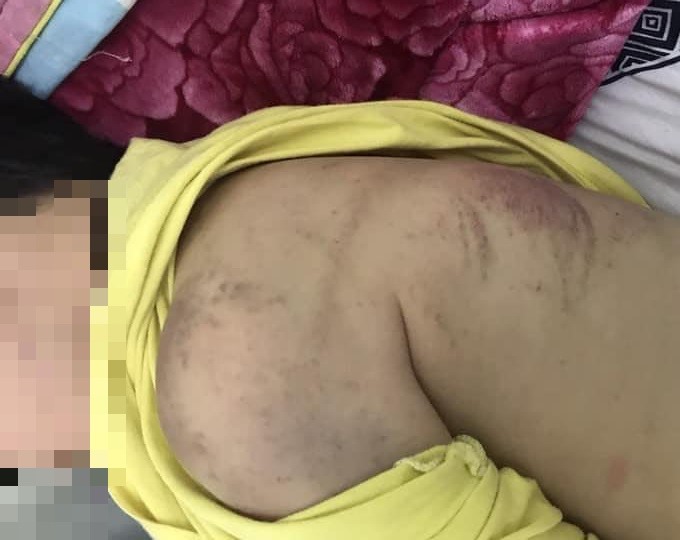 Xác minh thông tin bé trai 8 tuổi bị mẹ đẻ bạo hành vì chưa làm bài tập-1
