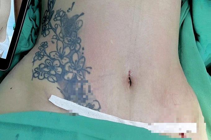 Người phụ nữ tử vong với nhiều vết mổ sau khi hút mỡ tại Bệnh viện Sao Hàn-2