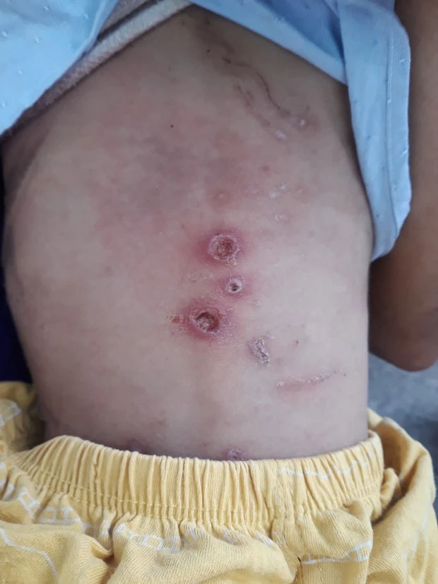 Bé trai 2 tuổi nghi bạo hành tại Hóc Môn hiện ra sao?-1