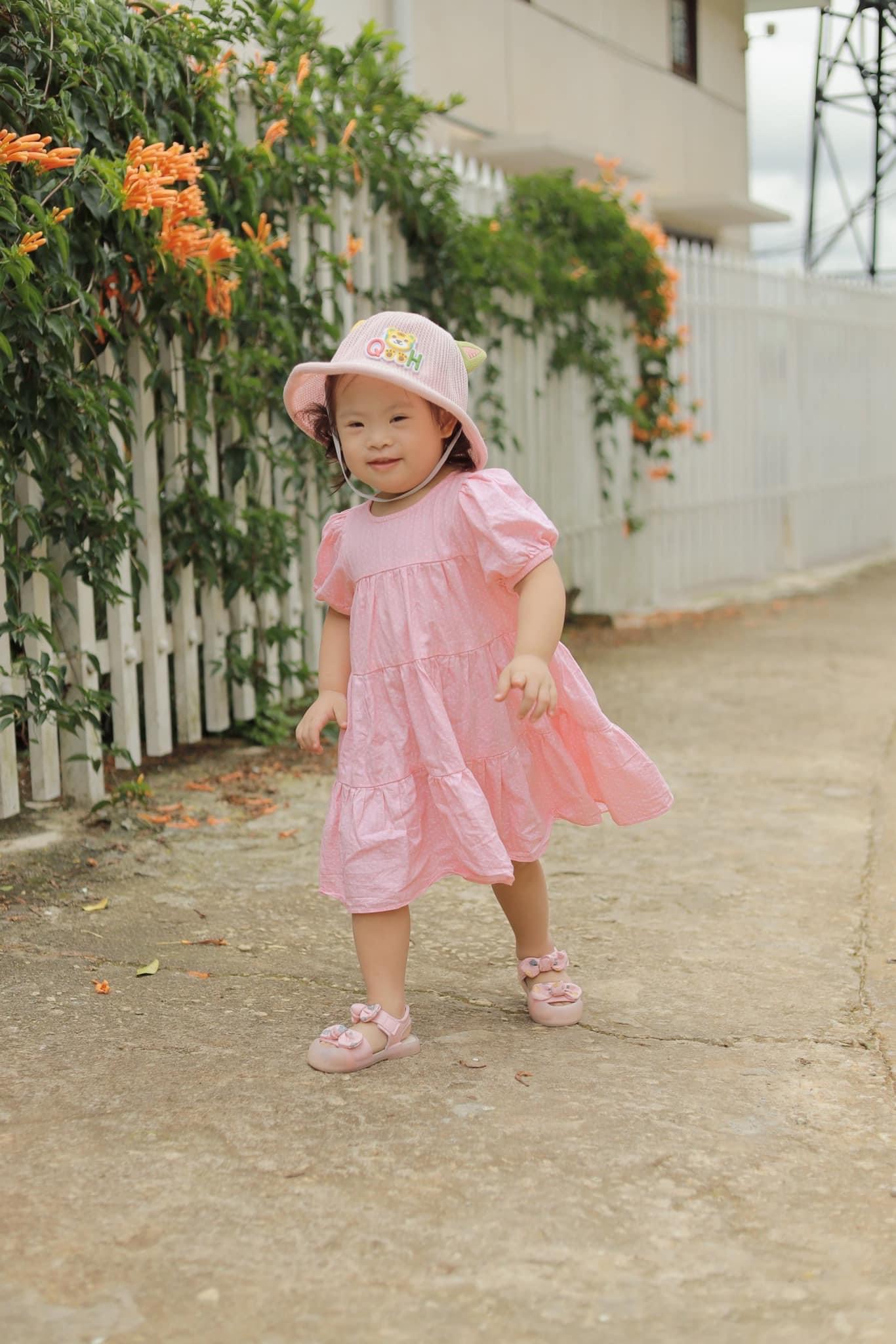 Dù không như bao em bé khác nhưng bố mẹ vẫn yêu những điều chưa hoàn hảo của con-3