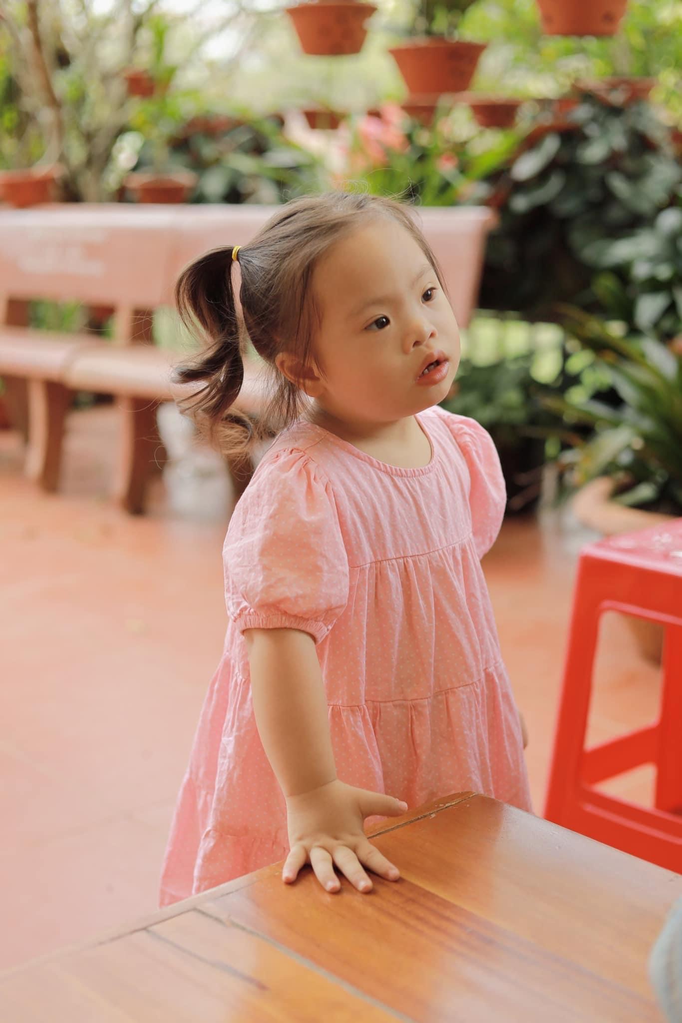 Dù không như bao em bé khác nhưng bố mẹ vẫn yêu những điều chưa hoàn hảo của con-4