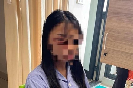 Công an giám định thương tích nữ sinh lớp 8 bị đánh hội đồng ở Hà Nội