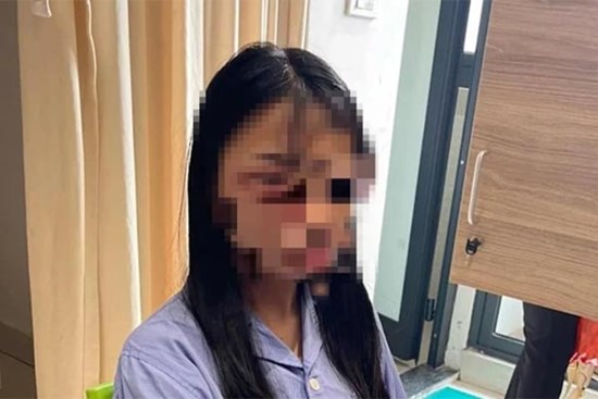 Công an giám định thương tích nữ sinh lớp 8 bị đánh hội đồng ở Hà Nội