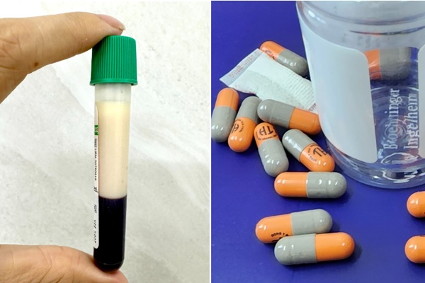 Dùng thuốc giảm cân, bé 13 tuổi huyết áp tăng vọt, men gan cao gấp 10 lần-2