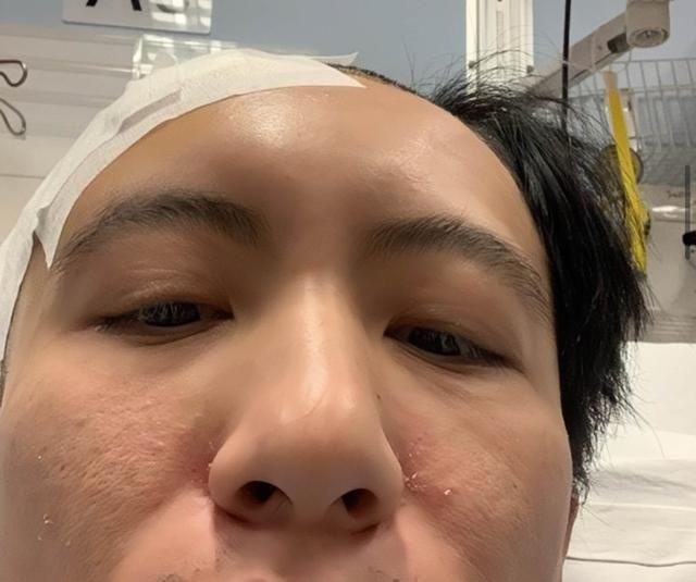 Nam diễn viên Hong Kong phẫu thuật não vì bị vợ bạo hành-3