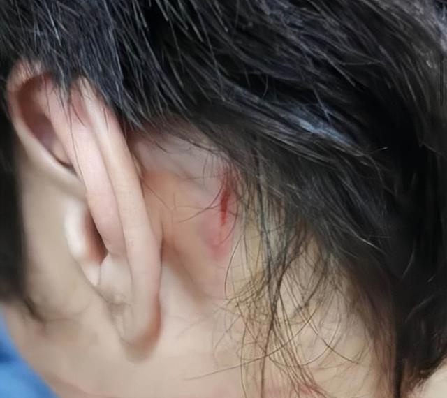 Nam diễn viên Hong Kong phẫu thuật não vì bị vợ bạo hành-4