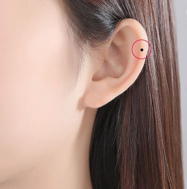 6 nốt ruồi quý hơn vàng, ai sở hữu 1/6 đã quá may mắn, phú quý cả đời-5