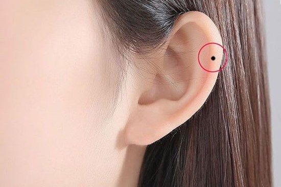 6 nốt ruồi quý hơn vàng, ai sở hữu 1/6 đã quá may mắn, phú quý cả đời